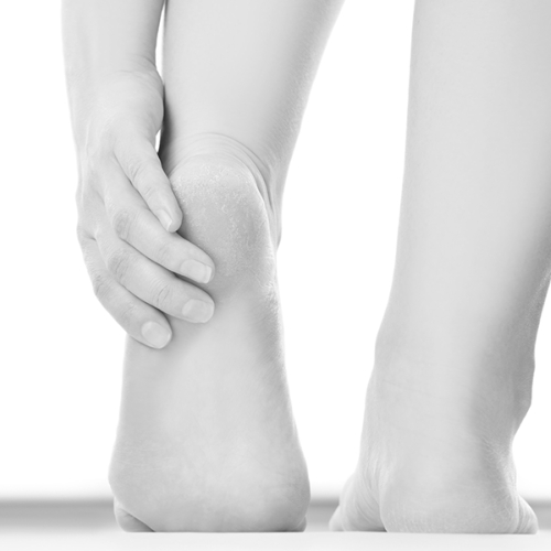 Quoi faire contre les cors aux pieds?