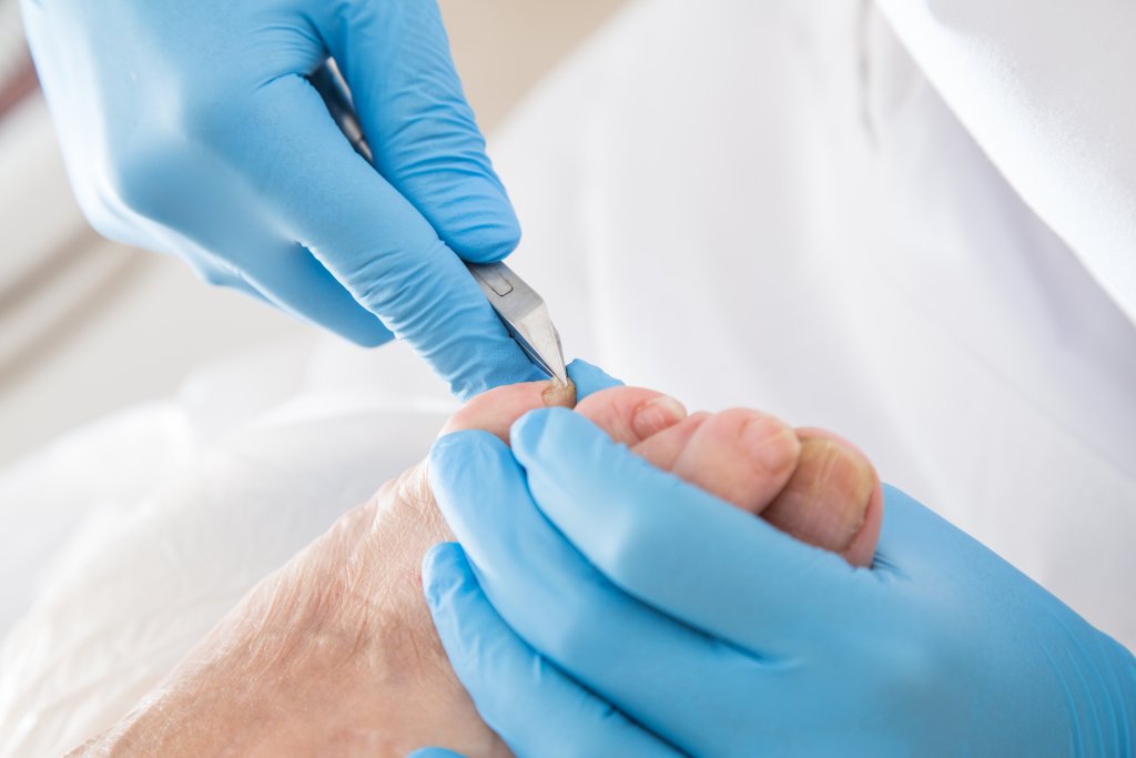 Soins des pieds: Quand et pourquoi?